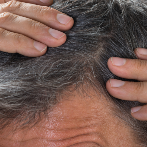 Shampoing en barre - cheveux pelliculaires et barbe